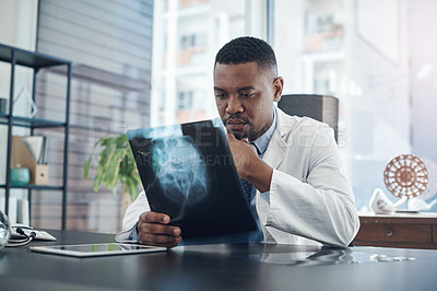 Buy stock photo Healthcare, black man and doctor with brain scan for diagnosis, check results or ideas in hospital. Neurology, thinking and surgeon with xray for assessment, decision or planning treatment on injury