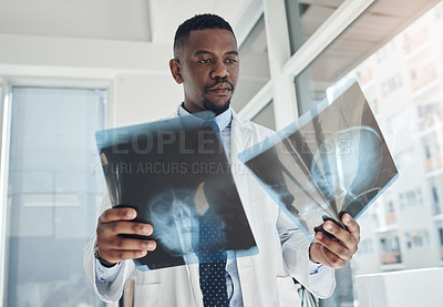 Buy stock photo Black doctor, x ray and thinking in hospital for healthcare, surgery and head injury in clinic. Surgeon, man and inspect patient file in office for consult, diagnosis or opinion for medicine or pills