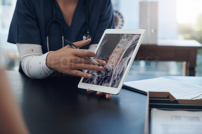 Buy stock photo Shot of an unrecognizable doctor showing a patient a digital x-ray in an office
