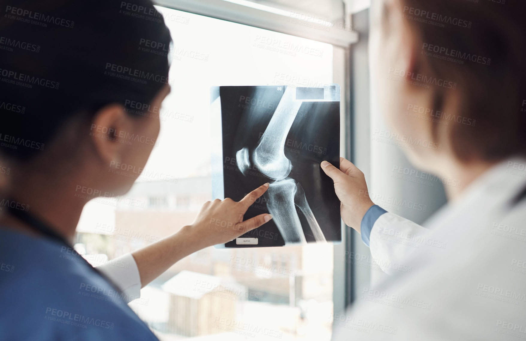 Buy stock photo Doctor, nurse and xray in radiology for bones in patient with examination, pointing for treatment in clinic. Medical, professionals and hospital with scan for diagnosis, wellness and healthcare