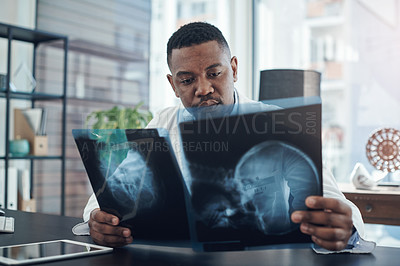 Buy stock photo Healthcare, black man and surgeon with brain scan for diagnosis, check results or ideas in hospital. Neurology, review and doctor with xray for assessment, decision or planning treatment on injury