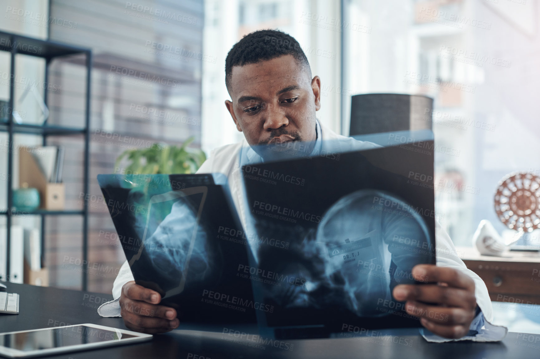 Buy stock photo Healthcare, black man and surgeon with xray for diagnosis, check results or ideas in hospital. Neurology, review and doctor with brain scan for assessment, bone cancer or planning treatment on tumor