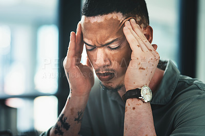 Buy stock photo Shot of a young businessman struggling with a headache in an office at work