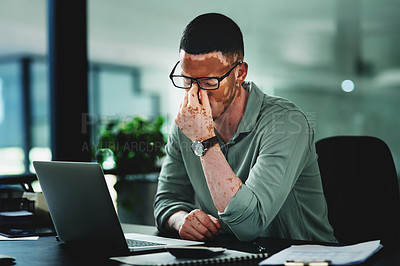 Buy stock photo Shot of a young businessman struggling with.a headache in an office at work