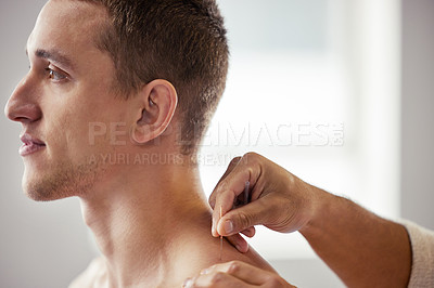 Buy stock photo Shot of a young man getting acupuncture