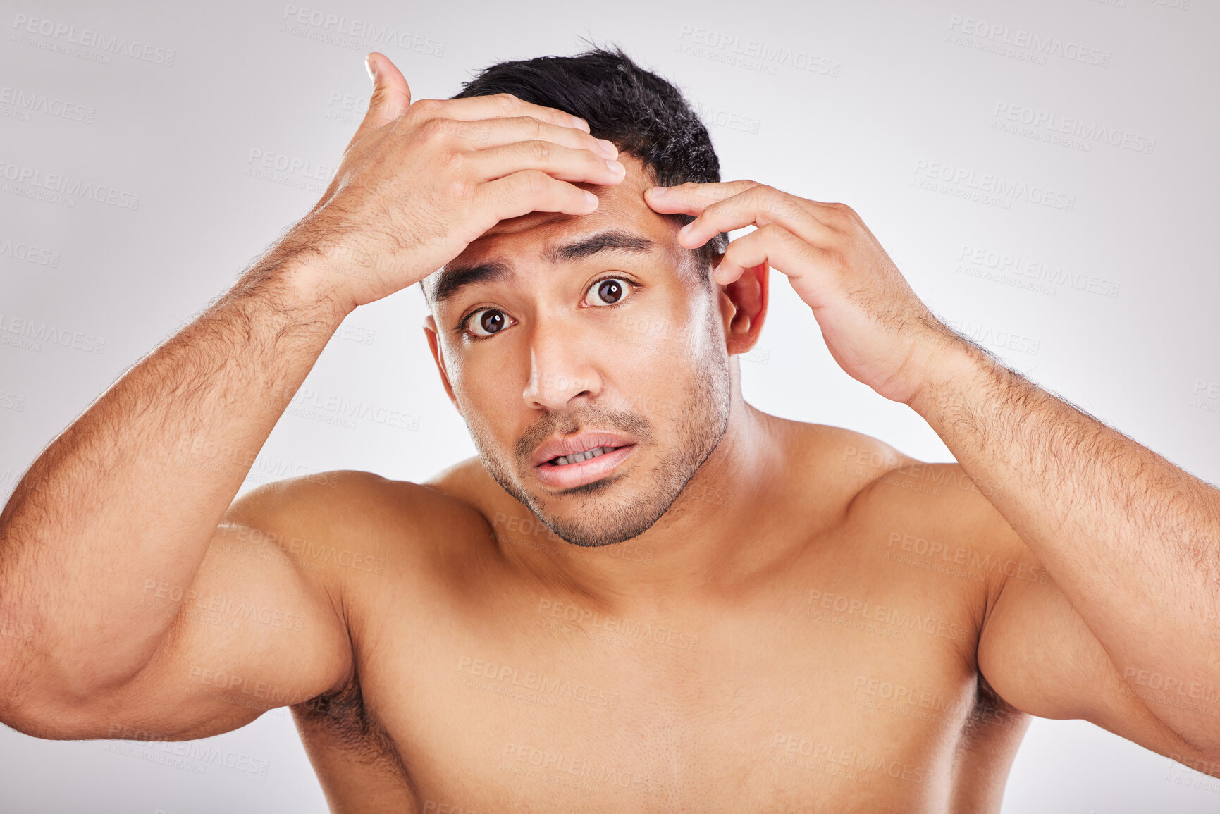 Buy stock photo Beauty, pimple and portrait of natural man in studio on white background for inspection or skincare. Acne, blemish and face of model in bathroom for cleaning, examination or aesthetic wellness