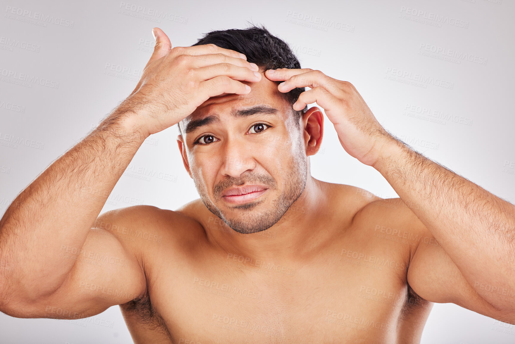 Buy stock photo Acne, beauty and portrait of natural man in studio on white background for inspection or skincare. Blemish, face and pimple of male model in bathroom for cleaning, examination or aesthetic wellness