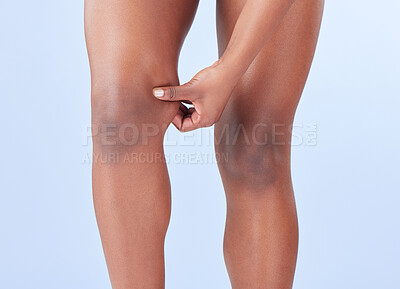 Buy stock photo Hands, skin and pinch knee by background in studio with check for cellulite, challenge or lose weight for healthy body. Girl, model or person with test, results or goal with cosmetic transformation