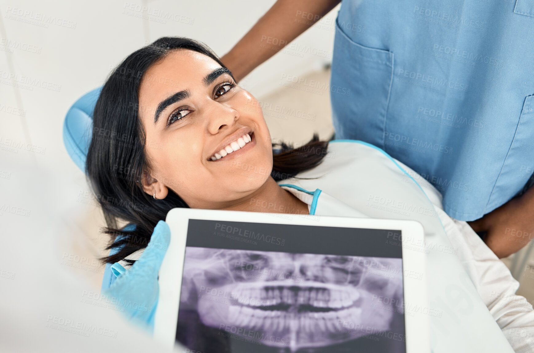 Buy stock photo Woman, dentist and smile with dental xray or results in clinic with satisfaction for teeth treatment with doctor. Female patient, satisfied and happy in consultation for canal procedure and oral care