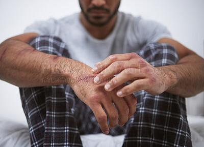 Buy stock photo Man, sad and hand scratch for depression, anxiety and trauma as patient with fear, scar and paranoid. Male person, ptsd and violence with mental health, psychosis and personality disorder for mind