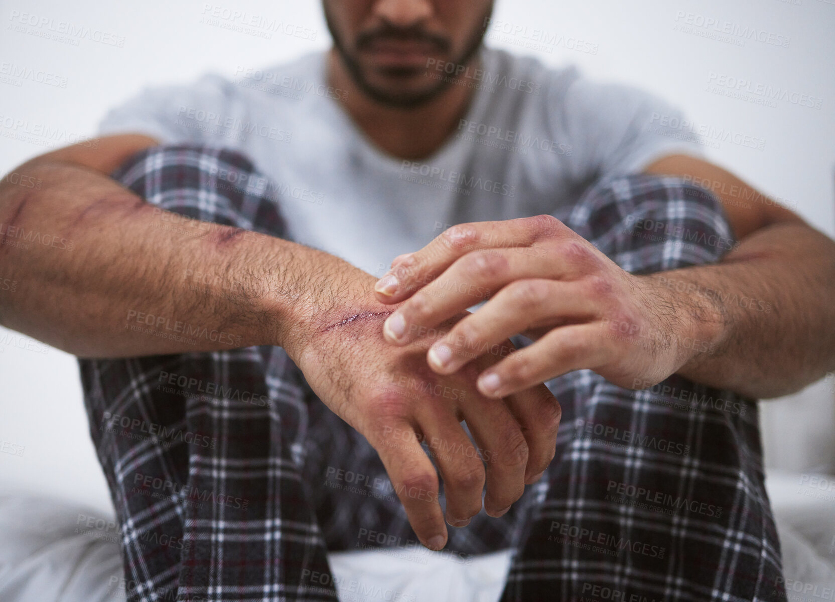 Buy stock photo Man, sad and hand scratch for depression, anxiety and trauma as patient with fear, scar and paranoid. Male person, ptsd and violence with mental health, psychosis and personality disorder for mind