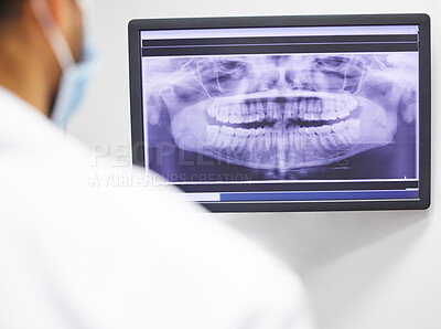 Buy stock photo Shot of a dentist analysing an x ray of a patient’s teeth