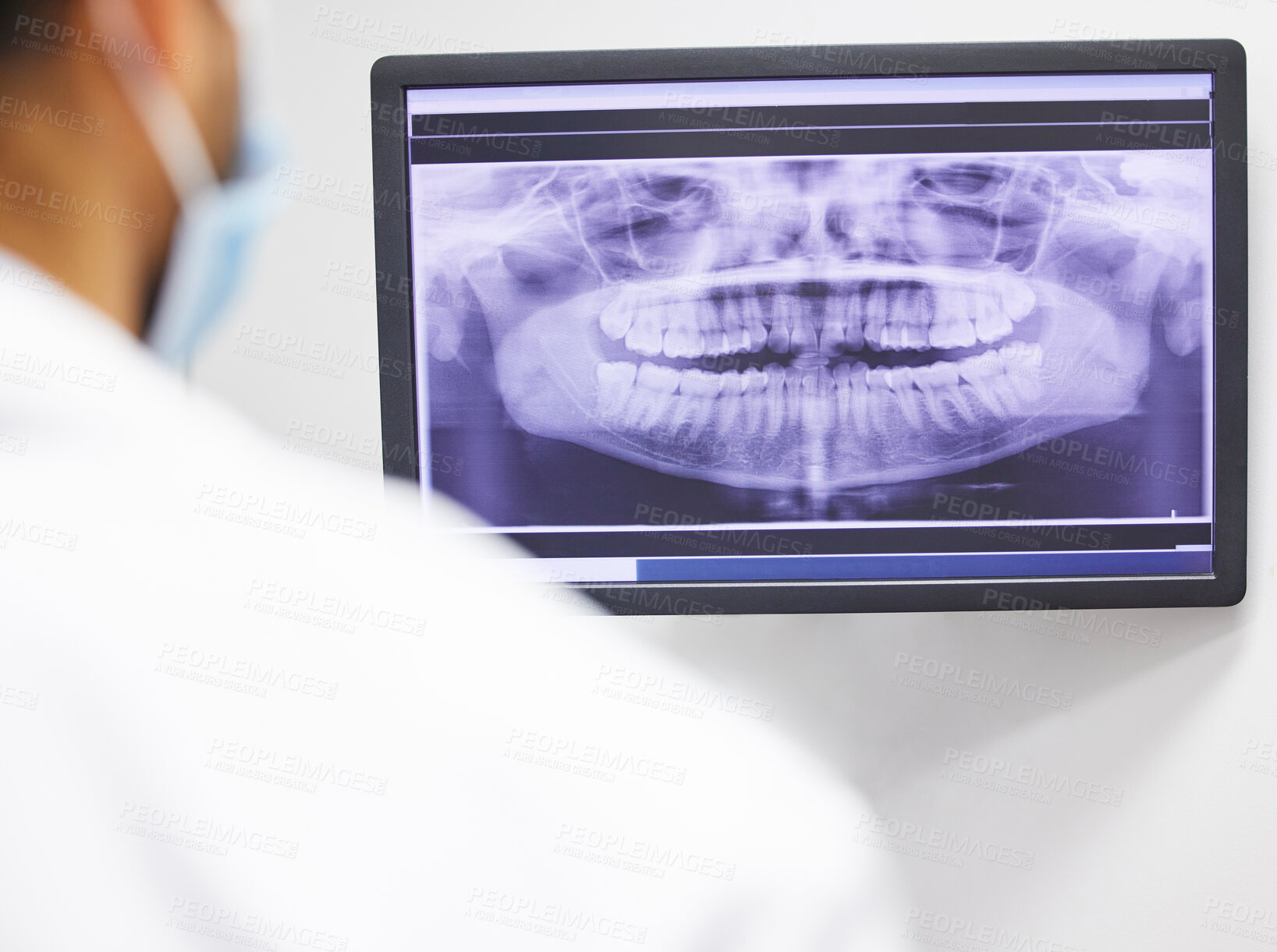 Buy stock photo Shot of a dentist analysing an x ray of a patient’s teeth