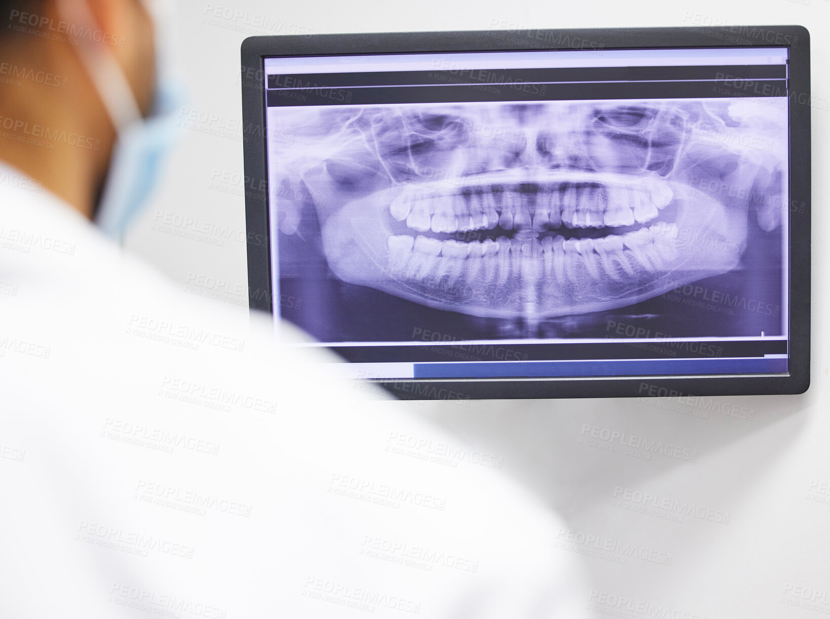 Buy stock photo Dentist, consultation and x ray of teeth on screen for anatomy education, dental diagnosis and treatment planning. Oral assessment, person and monitor with image for hygiene, health and wellness