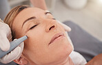 Micro needling minimises your pores