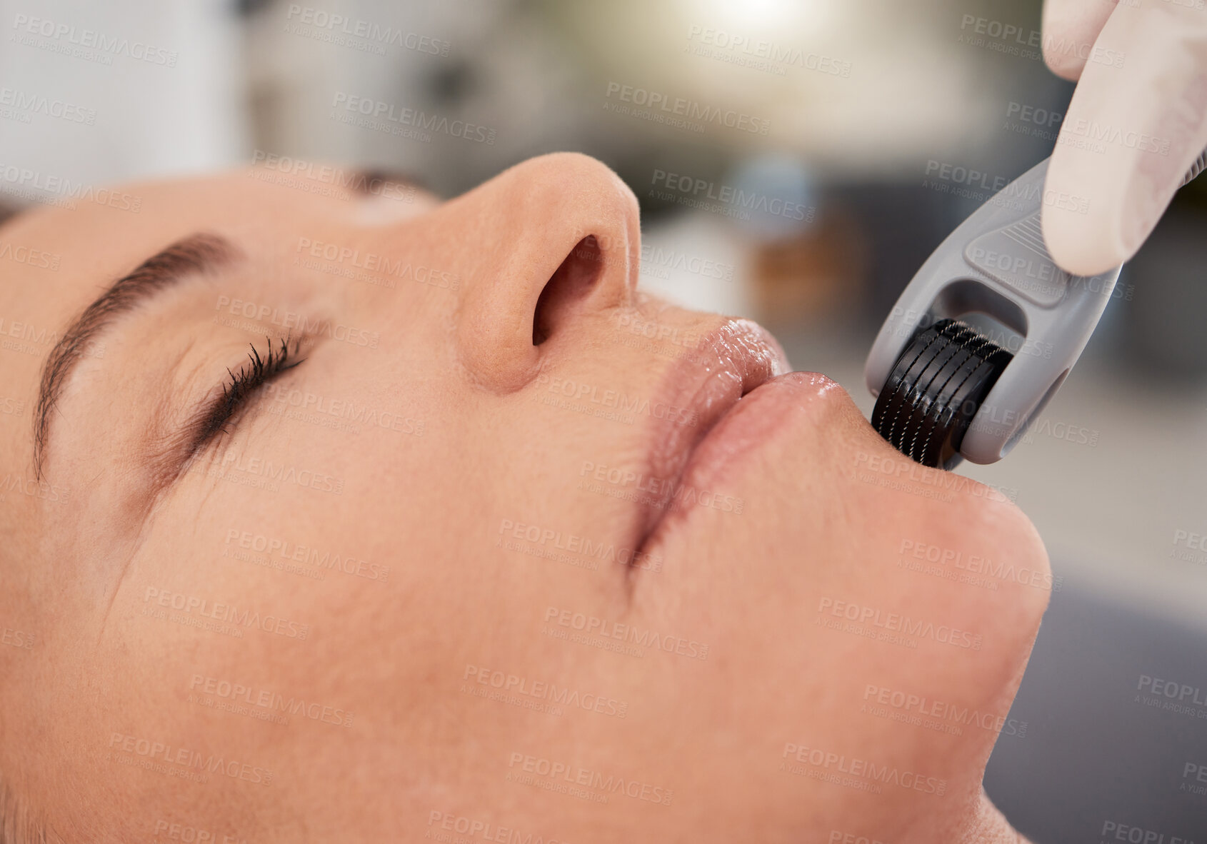 Buy stock photo Clinic, facial and woman with derma roller for mesotherapy, skincare and collagen treatment with anti aging benefits. Cosmetics, dermatology and client at beauty salon for microneedling skin process
