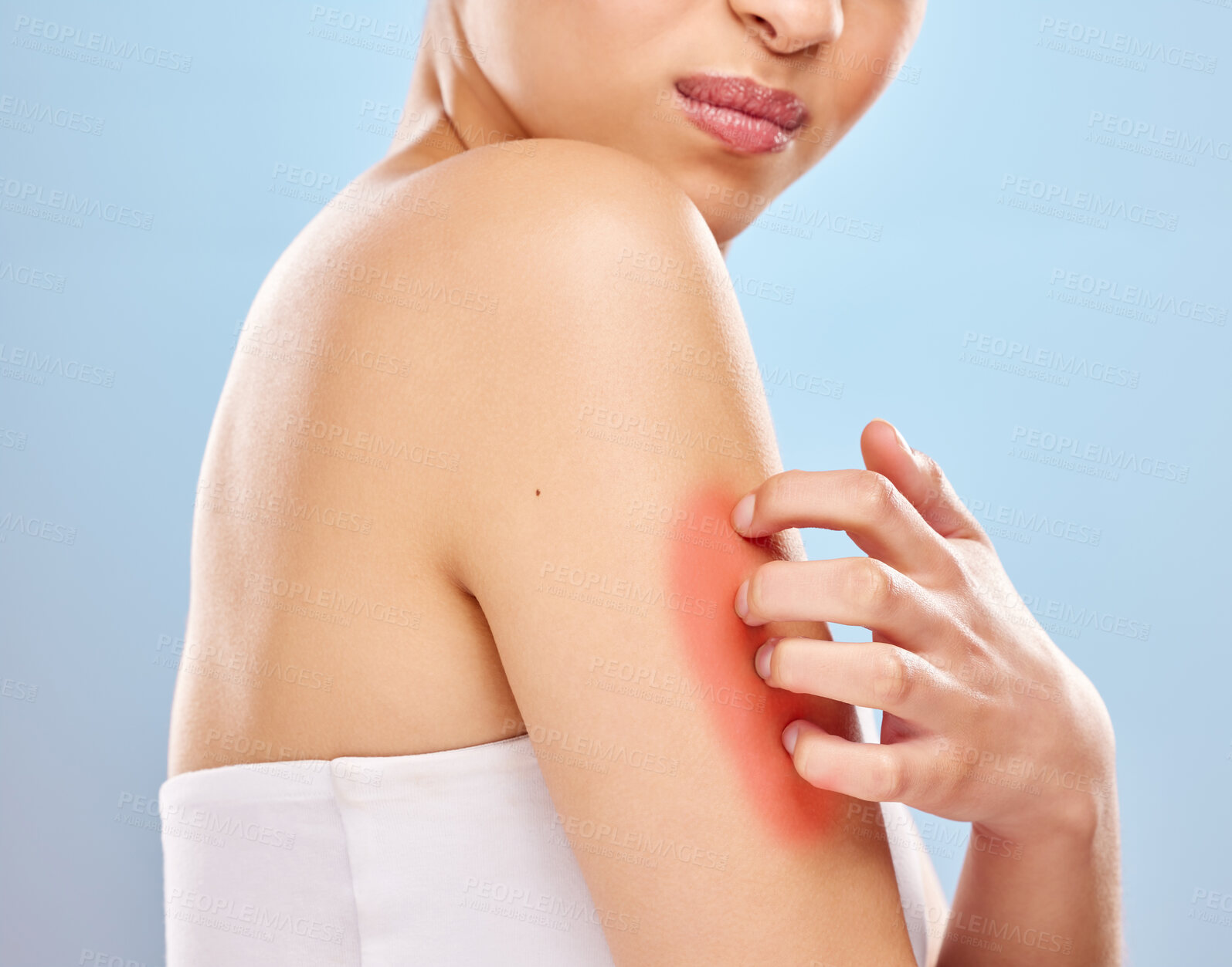 Buy stock photo Skin, scratch and woman in studio with rash on arm for virus or bacteria infection and eczema. Model girl, touch and red anatomy for food allergies with skincare problem or lupus by blue background