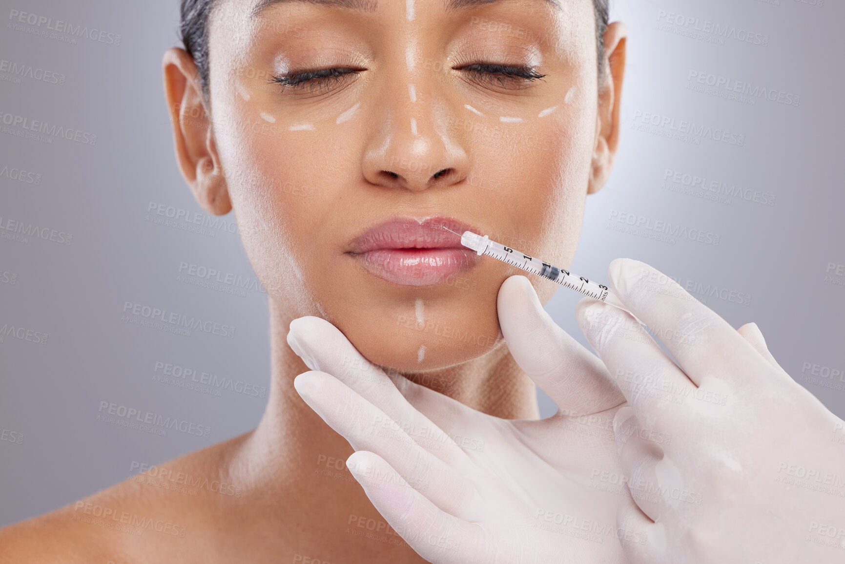 Buy stock photo Plastic surgery, aesthetic and lip filler with woman and injection for botox, dermatology and beauty. Pattern, change and medical with model and syringe on grey background for collagen and cosmetics