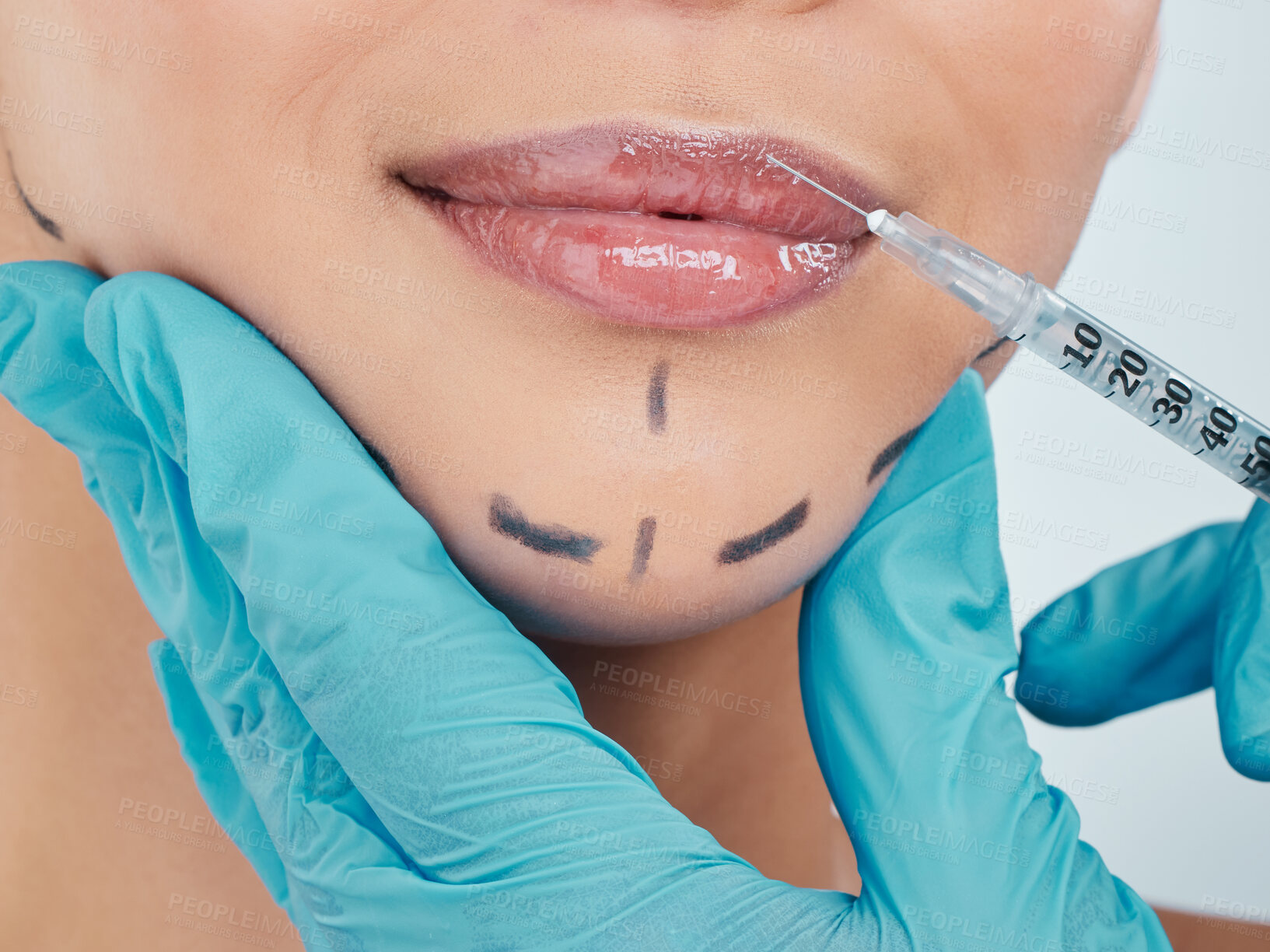 Buy stock photo Woman, injection and beauty with lip filler, cosmetic for results in cosmetology in background. Female person, treatment and needle for skincare, pride or glow for dermatology for wellness in studio
