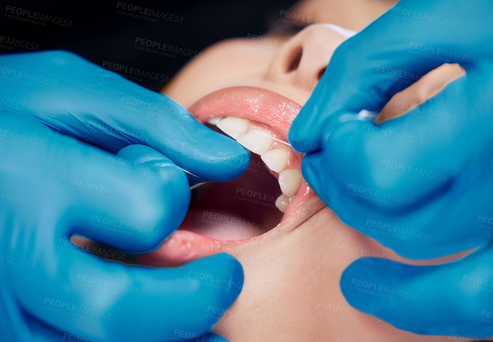 Buy stock photo Dentist, mouth closeup and flossing in clinic for hygiene with healthcare consultation and plaque removal. Cleaning teeth, doctor hands and dental string for healthy gums and gingivitis prevention