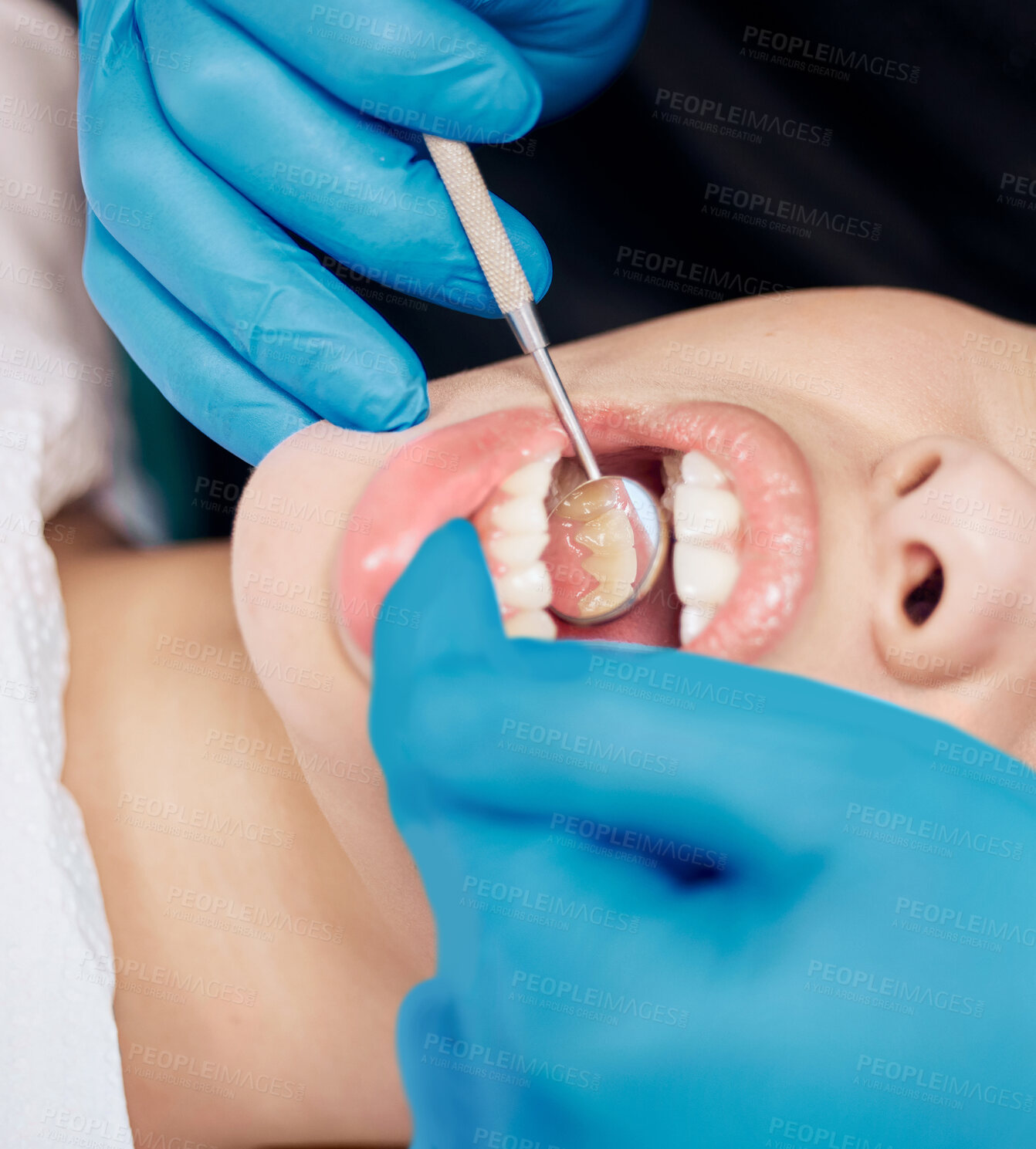 Buy stock photo Dentist hands, closeup inspection and mouth of person for hygiene with healthcare consultation and metal tools in clinic. Teeth check, patient and orthodontist equipment with medical exam for veneers