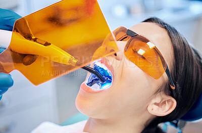 Buy stock photo Shot of a young woman getting her teeth whitened by her dentist