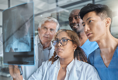 Buy stock photo Cropped shot of a group of medical professionals looking at an xray during a meeting in the hospital boardroom