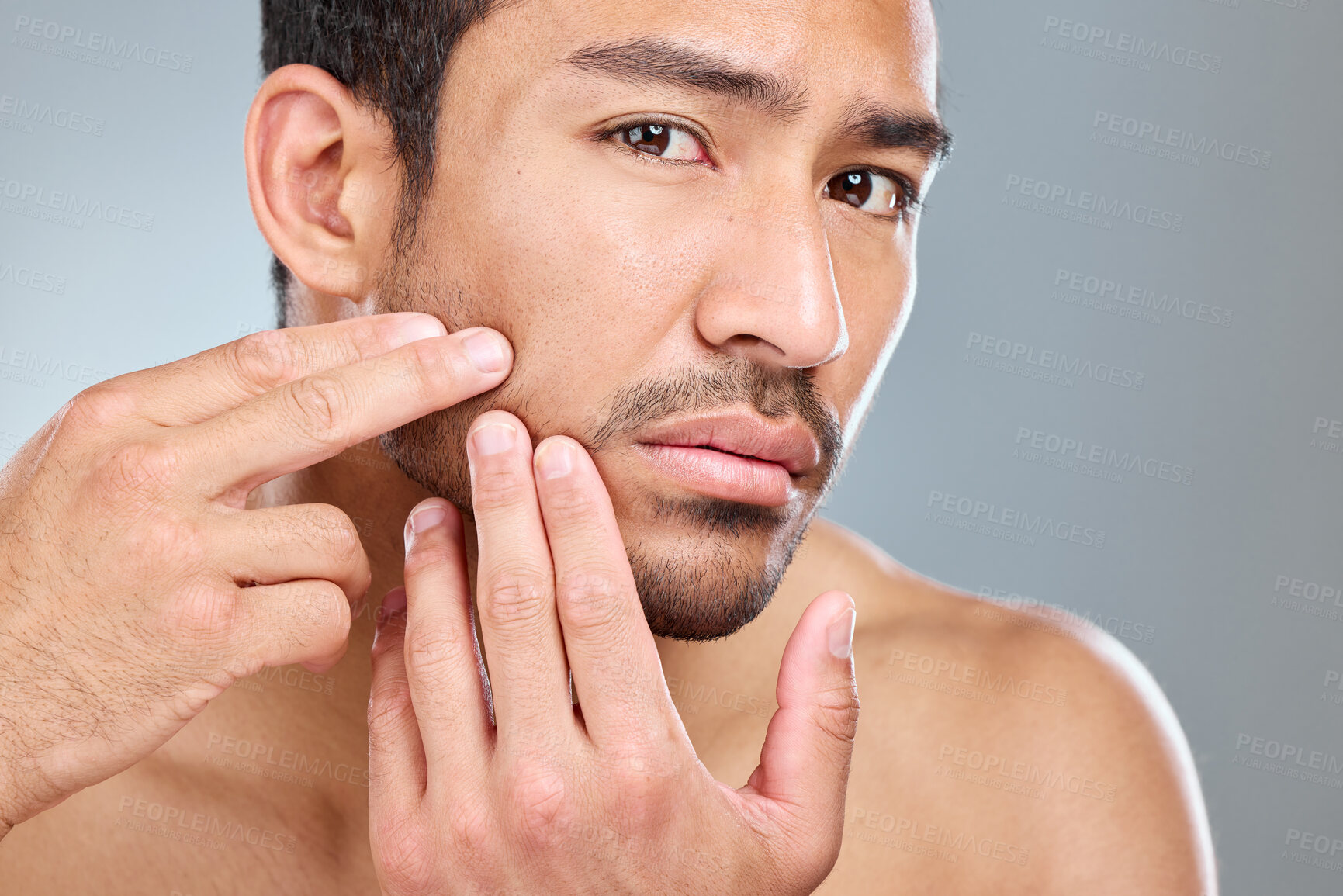 Buy stock photo Hands, skincare and pimple with man in studio, facial and wellness on white background. Dermatology, fingers or beauty for cosmetic acne for male person, dehydrated or selfcare for grooming treatment