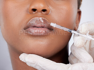 Buy stock photo Black woman, collagen and injection for lip filler, cosmetics and beauty on face with hyaluronic acid. Female person, mouth and syringe in studio on white background for treatment or transformation