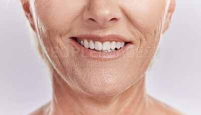 Buy stock photo Happy woman with teeth and smile, showing her natural looking dental veneers posing against a purple mockup studio background. Model woman happy with her oral healthcare hygiene and health skincare