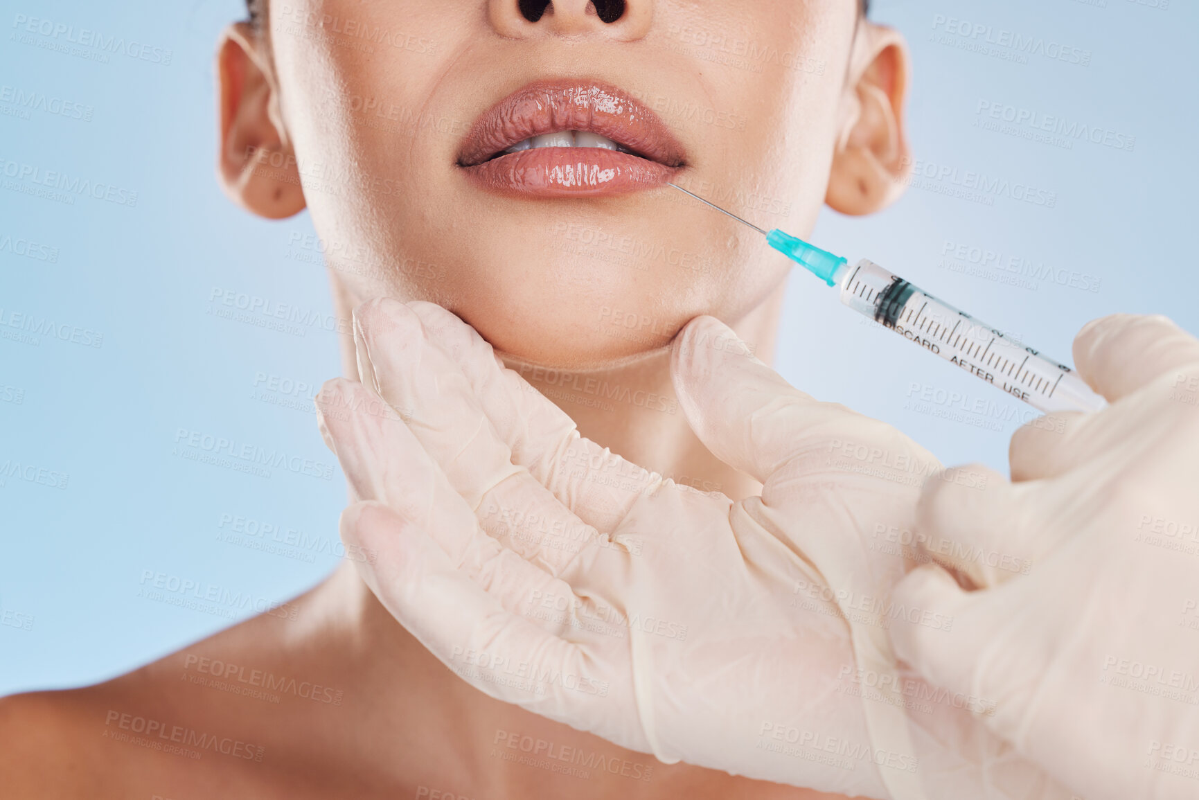 Buy stock photo Beauty, collagen and a woman getting a lip injection from a medical worker. Plastic surgery, dermal filler and cosmetic treatment for youth. Modern medicine skincare and make up for natural good look