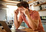 Young tired caucasian businessman suffering from a headache while working on a laptop from home alone. One stressed man looking unhappy while using a laptop. Person looking upset and worried