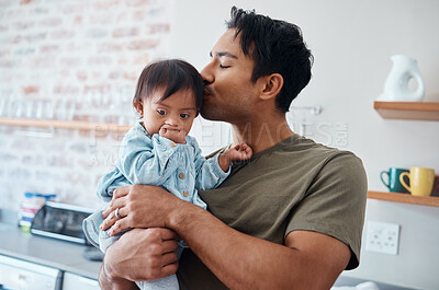 Buy stock photo Down syndrome baby bonding with father in their home, kiss and affection by caring parent for special needs infant. Love, family and children with asian parent embracing newborn with disability 