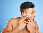 Health, skincare and man popping acne in face with blue background. Mens skin care, morning facial and young guy with flaws, blemish and imperfection pop pimple or blackhead with fingers and hands.