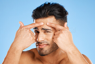 Buy stock photo Skincare, confused and portrait of acne man with hands on face feeling pimple with anxiety, doubt and stress. Model in studio analyzing skin with facial aesthetic problem on blue background.


