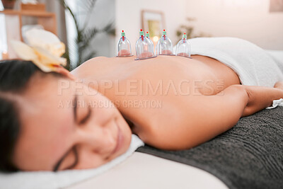 Buy stock photo Asian massage, cupping therapy and luxury spa for woman in physical therapy for back pain, wellness detox treatment and alternative medicine. Zen therapy exercise, organic wellness and stress relief 