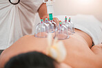 Zoom, physiotherapy or woman with back pain relax with cupping therapy for physical therapy, wellness massage for meditation help. Medicine, medical or luxury health tech for zen in spa for support