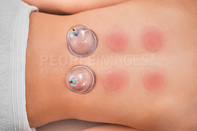 Buy stock photo Cupping, therapy and spa with a woman customer lying on a massage table in a beauty center from above. Relax, luxury or wellness with the back of a female in a health center for suction cup treatment