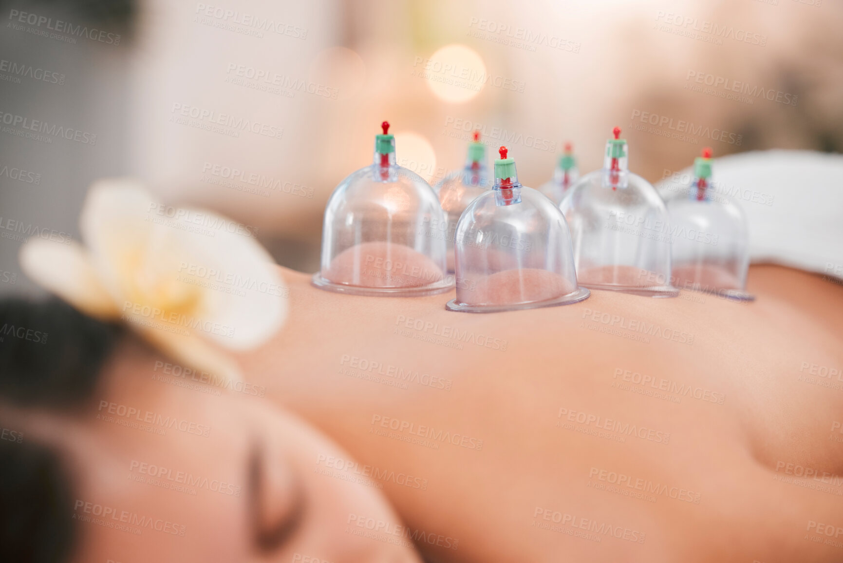 Buy stock photo Cupping therapy, spa and zen woman for chinese alternative medicine treatment for back pain and health. Bodycare and wellness with cup therapy for stress relief, wellbeing wiith cups and heat on skin
