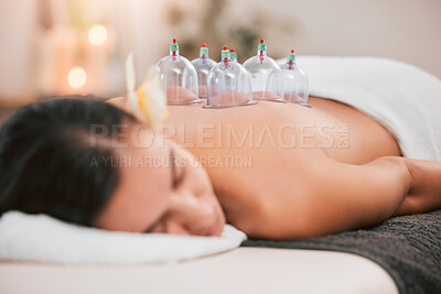 Spa in singapore, physiotherapy or cupping therapy woman for massage, back pain or luxury wellness medical help. Asian medicine, health or relax girl for zen, spiritual or stress healing therapy