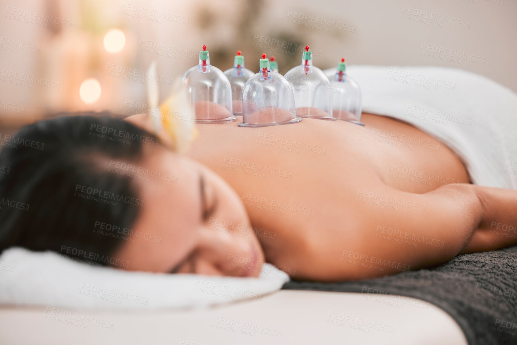 Buy stock photo Spa, physiotherapy or cupping therapy woman for massage, back pain or luxury wellness medical help. Asian medicine, health or relax girl for zen, spiritual or stress healing therapy with vacuum cups