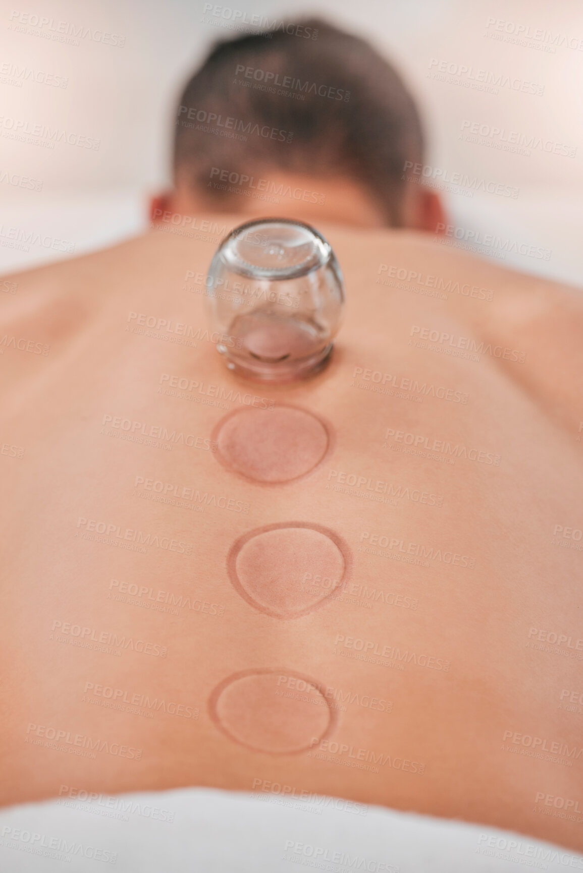 Buy stock photo Wellness, man and cupping massage at spa for relief in stress, inflammation and back pain, healthcare and relax. Cupping therapy, back and guy in resort for alternative therapy, acupuncture and rest