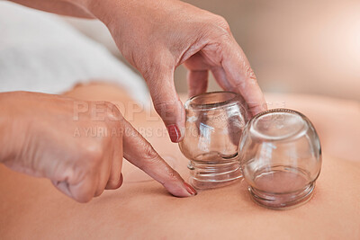 Buy stock photo Cupping, therapy and back massage at a wellness, health and beauty spa at a self care resort. Healing, body care and hands of a therapist doing healthy treatment with vacuum glasses for stress relief