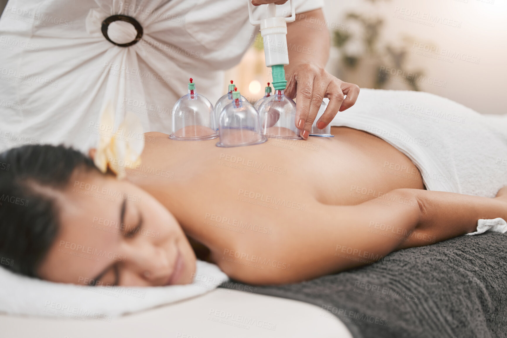 Buy stock photo Relax, health and cupping with woman in spa for alternative medicine, healing and physiotherapy. Peace, wellness and consulting with patient and hands of massage therapist for zen, holistic or muscle