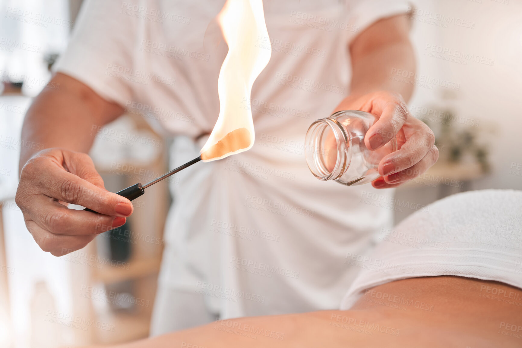 Buy stock photo Fire massage, flame and heating for cupping spa therapy for holistic wellness with glass jars. Beauty, luxury skincare and body treatment of a physical therapy session to find relax, peace and health