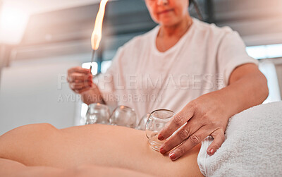 Buy stock photo Relax, cupping massage and man at a spa for wellness, healing and holistic therapy with woman therapist. Hand cup therapy and fire treatment on client at resort for toxins, blood and circulation