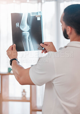 Buy stock photo Man, physiotherapist and x ray scan analysis in sports clinic for broken bone check, healthcare wellness or knee injury surgery planning. Medical worker, xray image or test results for physiotherapy