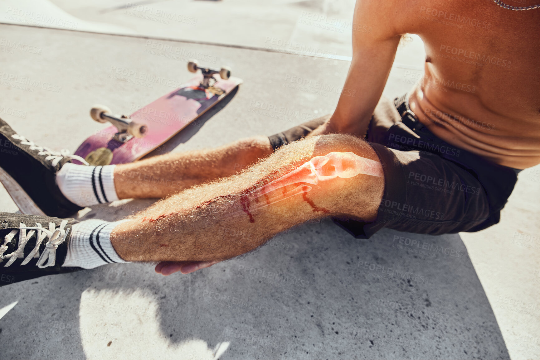 Buy stock photo Skateboard injury, pain and legs of man after fitness, exercise or sports workout in skatepark. Medical emergency, training accident problem and athlete skater anatomy of broken knee bone with blood