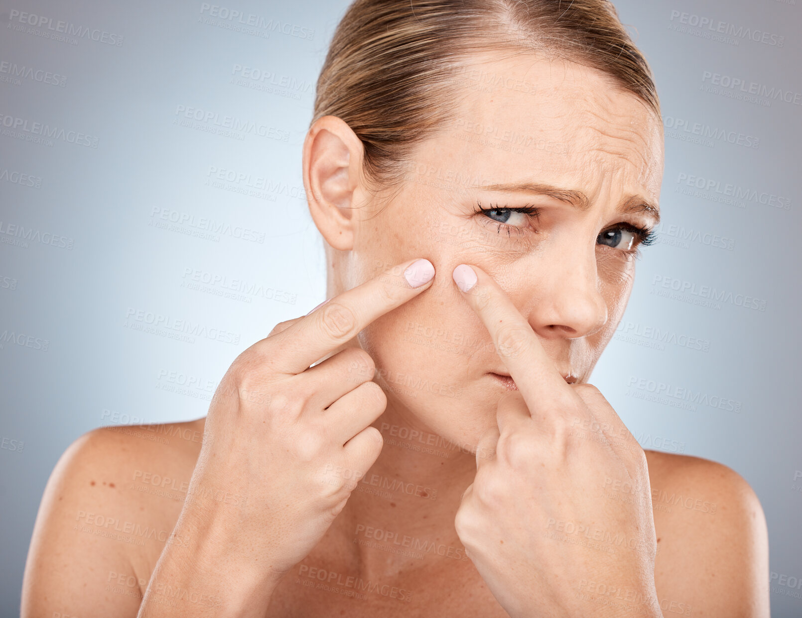 Buy stock photo Face, skincare and woman squeeze acne, pimple or blackhead in studio on a gray background. Wellness, dermatology and cosmetology portrait of sad female model from Canada worried about skin health.