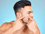 Man, hands and pop acne of face for skincare, beauty wellness or skin dermatology. Indian man, upset and press facial pimples or blackhead in blue background studio for morning cosmetics care 